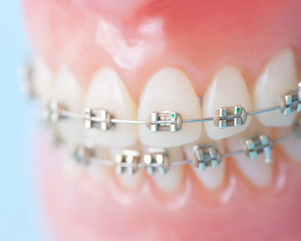 特徴1.矯正治療専門の歯科医院