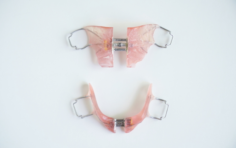 当院でのお子さまの矯正治療について